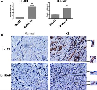 Role of Interleukin-1 Family Members and Signaling Pathways in KSHV Pathogenesis